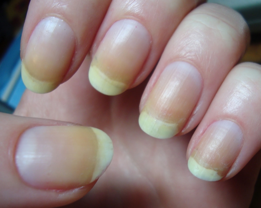 3. Lemon Print Nails - wide 1